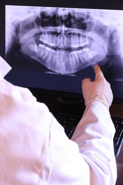 Best Root Canal Emergency Dentist  in Williston, ND